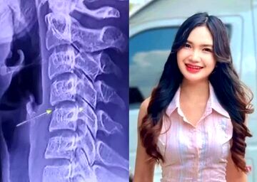 ماساژ گردن، خواننده تایلندی را به کشتن داد/ عکس

