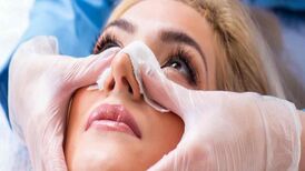 آیا عمل شکستگی بینی شامل بیمه میشود