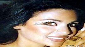 چهره عجیب خواننده زن مشهور قبل از عمل بینی/ عکس